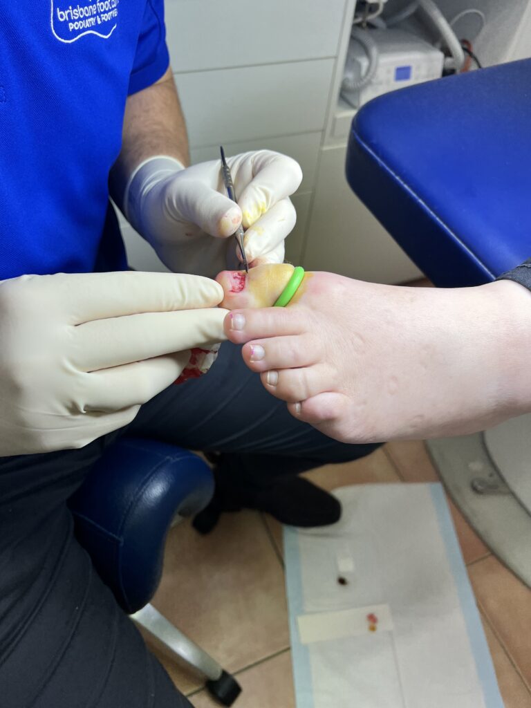 https://brisbanefootclinic.com.au/wp-content/uploads/2023/11/IMG_4822-768x1024.jpeg
