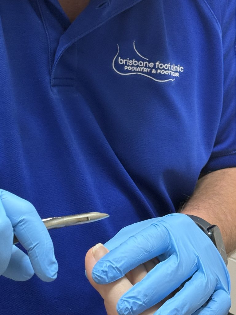 https://brisbanefootclinic.com.au/wp-content/uploads/2026/06/Close-of-trimming-nails-with-branding-768x1024.jpeg