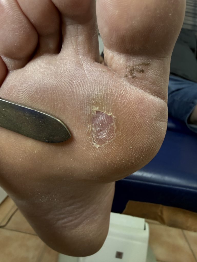 https://brisbanefootclinic.com.au/wp-content/uploads/2026/06/IMG_0611-768x1024.jpeg