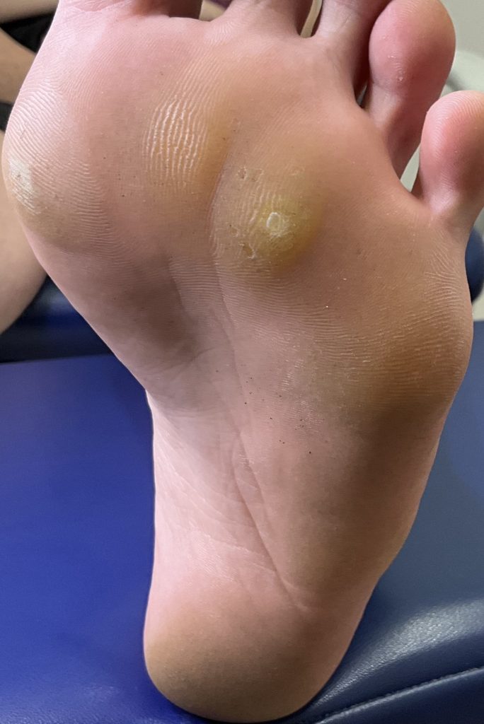 https://brisbanefootclinic.com.au/wp-content/uploads/2026/06/IMG_1269-684x1024.jpeg